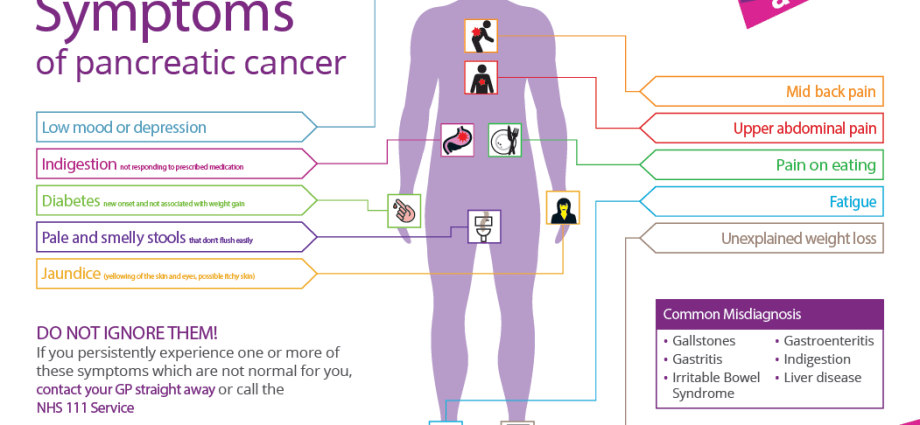 A breakthrough in the diagnosis of pancreatic cancer