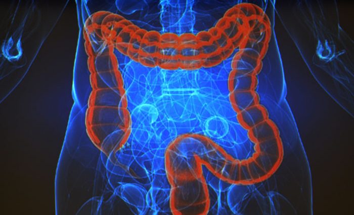 A breakthrough in the treatment of colon cancer. The new drug gave subjects a complete remission