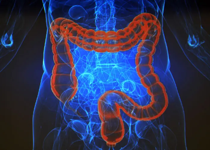 A breakthrough in the treatment of colon cancer. The new drug gave subjects a complete remission