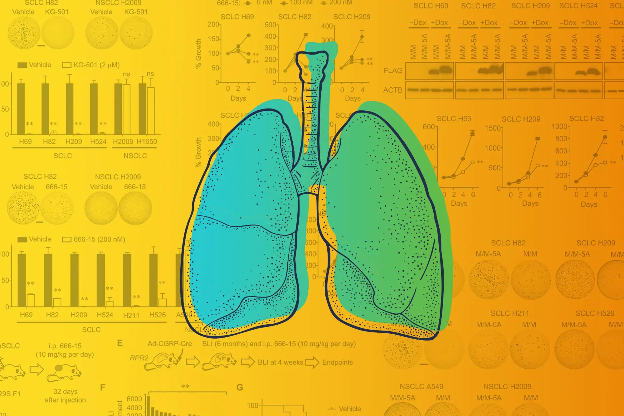 A breakthrough in the treatment of lung cancer. Scientists know how to stop disease