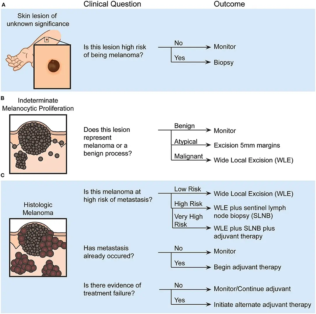 A combination of drugs helps 60 percent. patients with melanoma