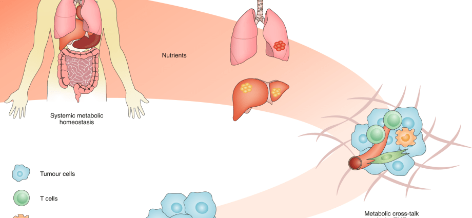 A computer model of tumor metabolism will help in the fight against the disease