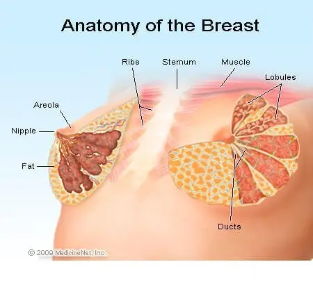 A dangerous breast lump