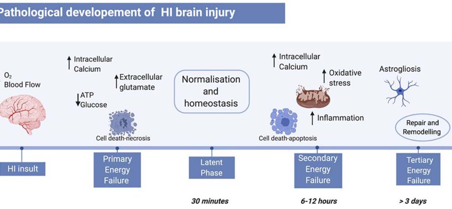 A drug has been discovered to help repair the effects of brain hypoxia in newborns