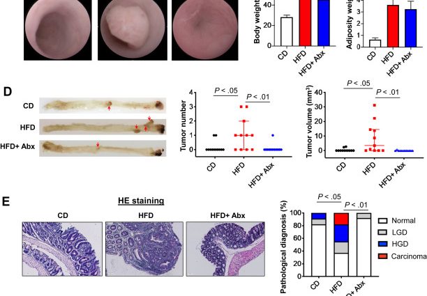 A fatty diet promotes colon cancer