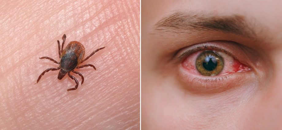 A fever of bleeding eyes near Poland. Ticks carry it