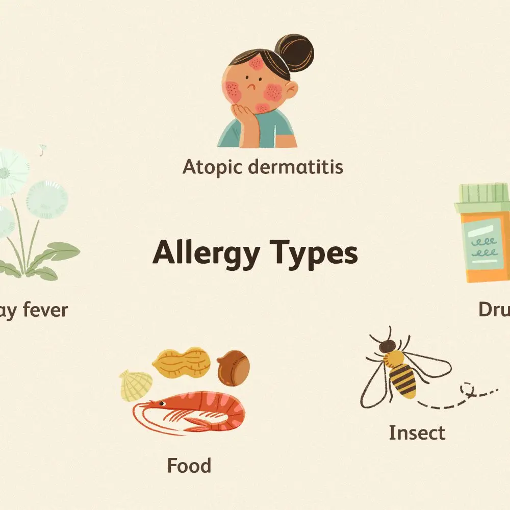 A few questions about allergies &#8211; tell us about your symptoms and see how many people responded as well as you!