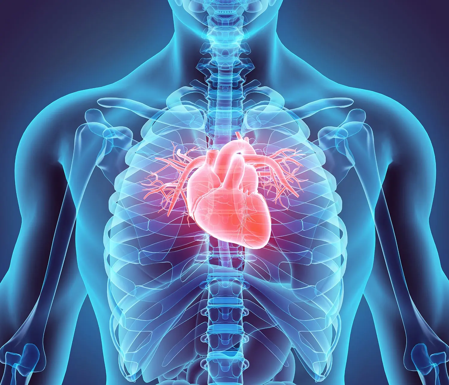 A heart attack in COVID-19 patients damages the heart more