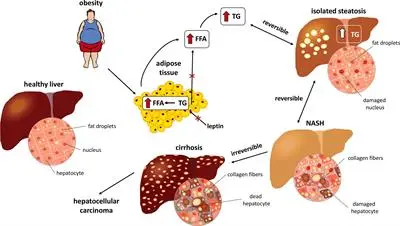 A mechanism has been found to protect the liver against steatosis