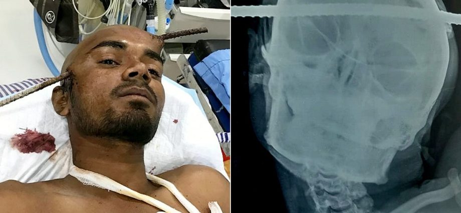 A metal rod pierced his skull. He survived, but became someone else