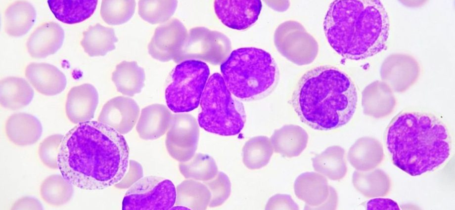 A new cure for leukemia coming soon?