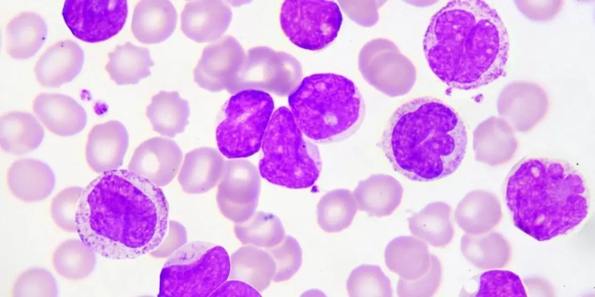 A new cure for leukemia coming soon?