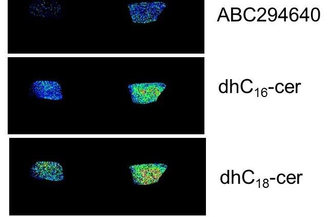 A new drug slows the growth of cancer