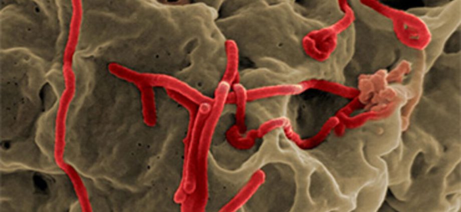 A new pathogen has been isolated. It is a relative of the Ebola virus and may take over Europe