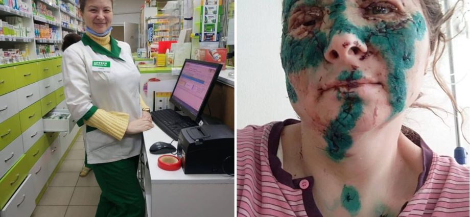 A pharmacist from Kharkiv survived the bombing. Works despite severe facial injuries