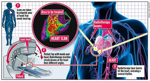 A pioneering operation saved the life of a 16-year-old with a cardiac arrhythmia