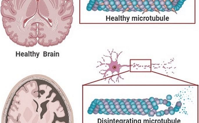 A popular pesticide causes Alzheimer&#8217;s disease. It is already known how