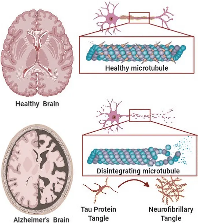 A popular pesticide causes Alzheimer&#8217;s disease. It is already known how