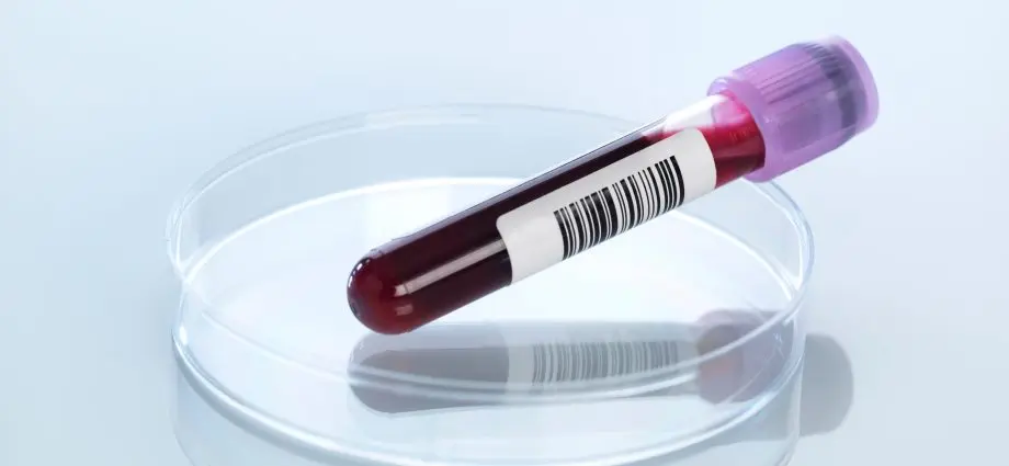 A simple blood test will detect Alzheimer&#8217;s