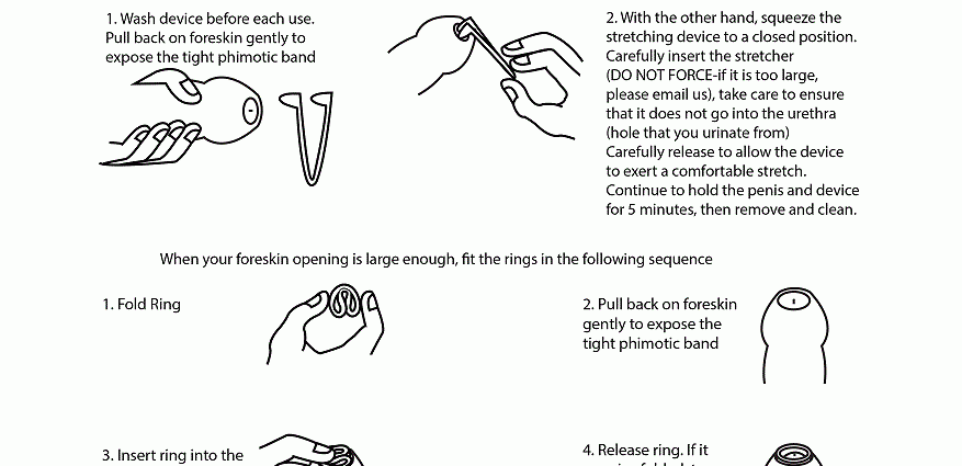 A small skin fold or foreskin