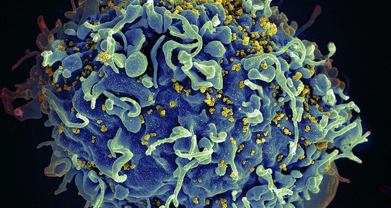 A stem cell transplant could prove to be a cure for HIV. Another patient was freed from the virus thanks to this method