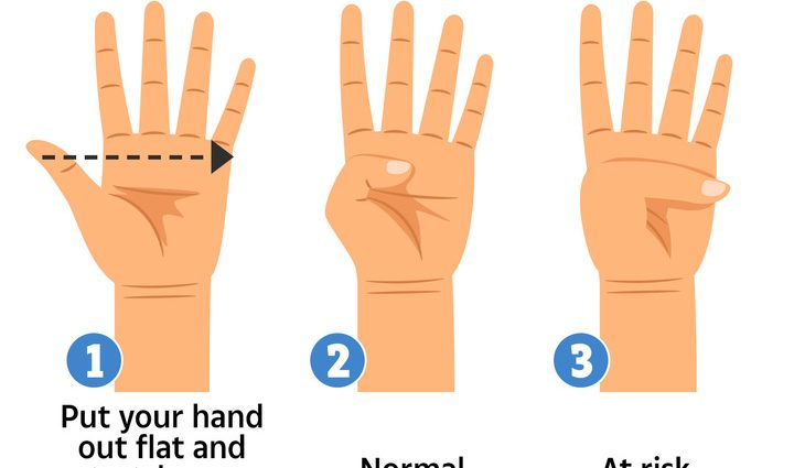 A thumb test will find out if you are at risk of having an aortic aneurysm