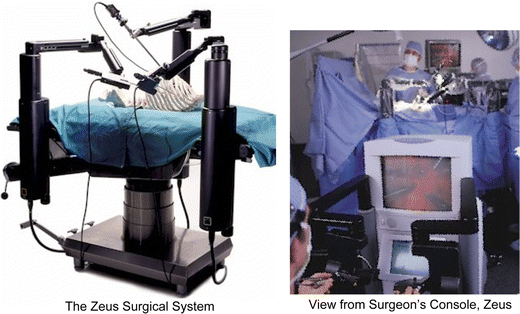 A woman and a robot, or surgery of the XNUMXst century