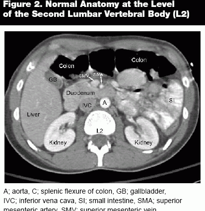 Abdominal Computed Tomography &#8211; How to Interpret the Results?