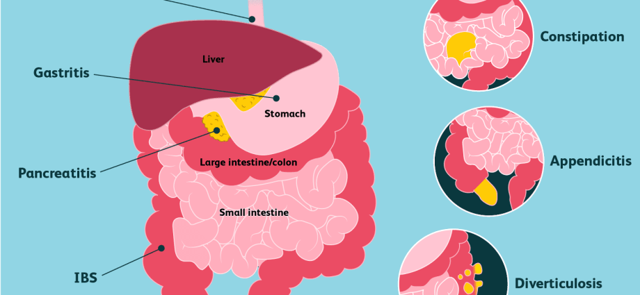 Abdominal pain on the right side? Here&#8217;s what it means and when you need to see a doctor