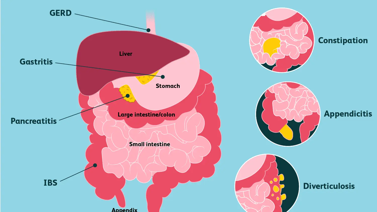 Abdominal pain on the right side? Here&#8217;s what it means and when you need to see a doctor