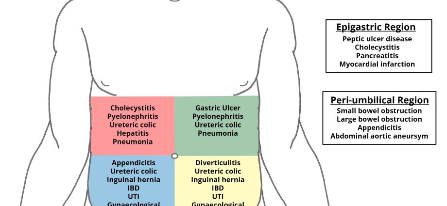 Abdominal pain &#8211; pathogenesis, diagnosis, what diseases may indicate