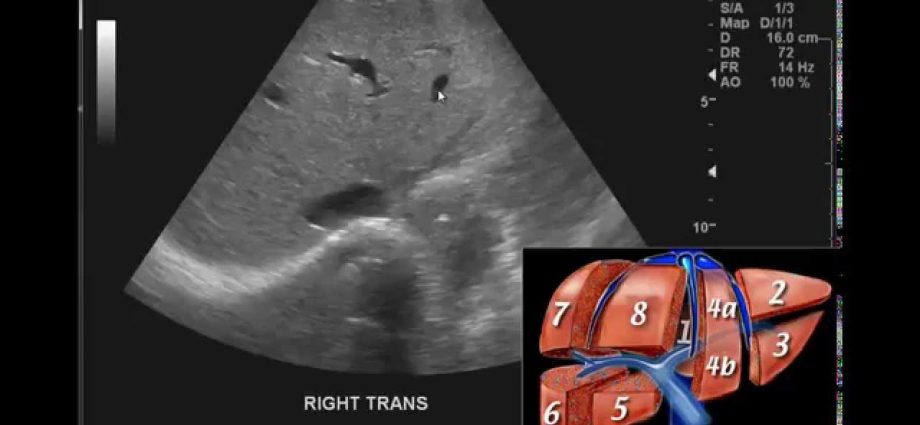 Abdominal ultrasound &#8211; how to interpret the results?