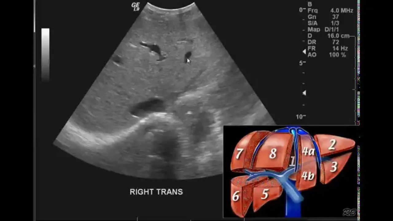 Abdominal ultrasound &#8211; how to interpret the results?