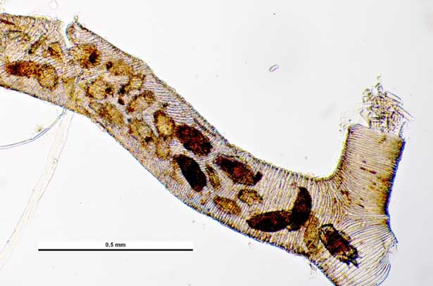 Acarapidosis of bees