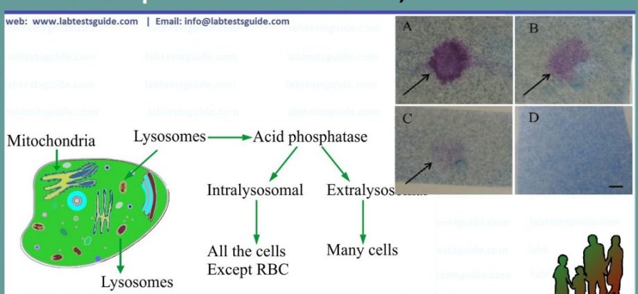 Acid phosphatase in the body. When should an acid phosphatase test be performed?