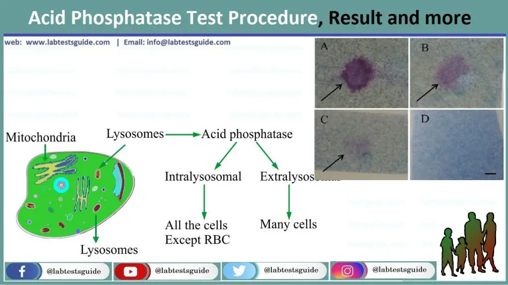 Acid phosphatase in the body. When should an acid phosphatase test be performed?