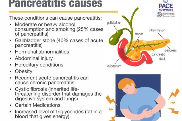 Acute pancreatitis &#8211; causes, symptoms, treatment