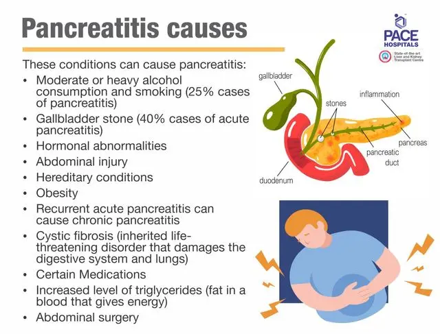 Acute pancreatitis - causes, symptoms, treatment - Healthy Food Near Me