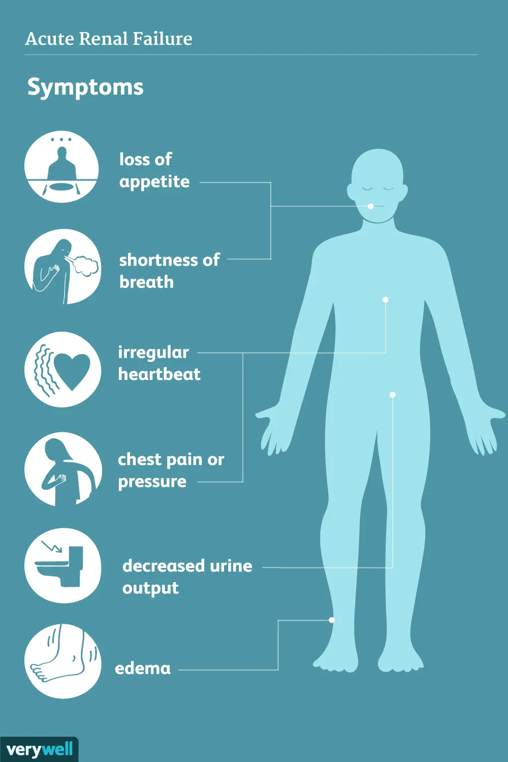 Acute stoppage of urine output