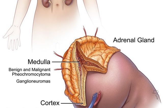 Adenoma of the adrenal gland &#8211; symptoms, treatment