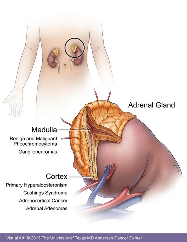 Adenoma of the adrenal gland &#8211; symptoms, treatment