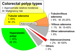 Adenoma &#8211; what is it and how is it manifested? The six most common types of adenoma