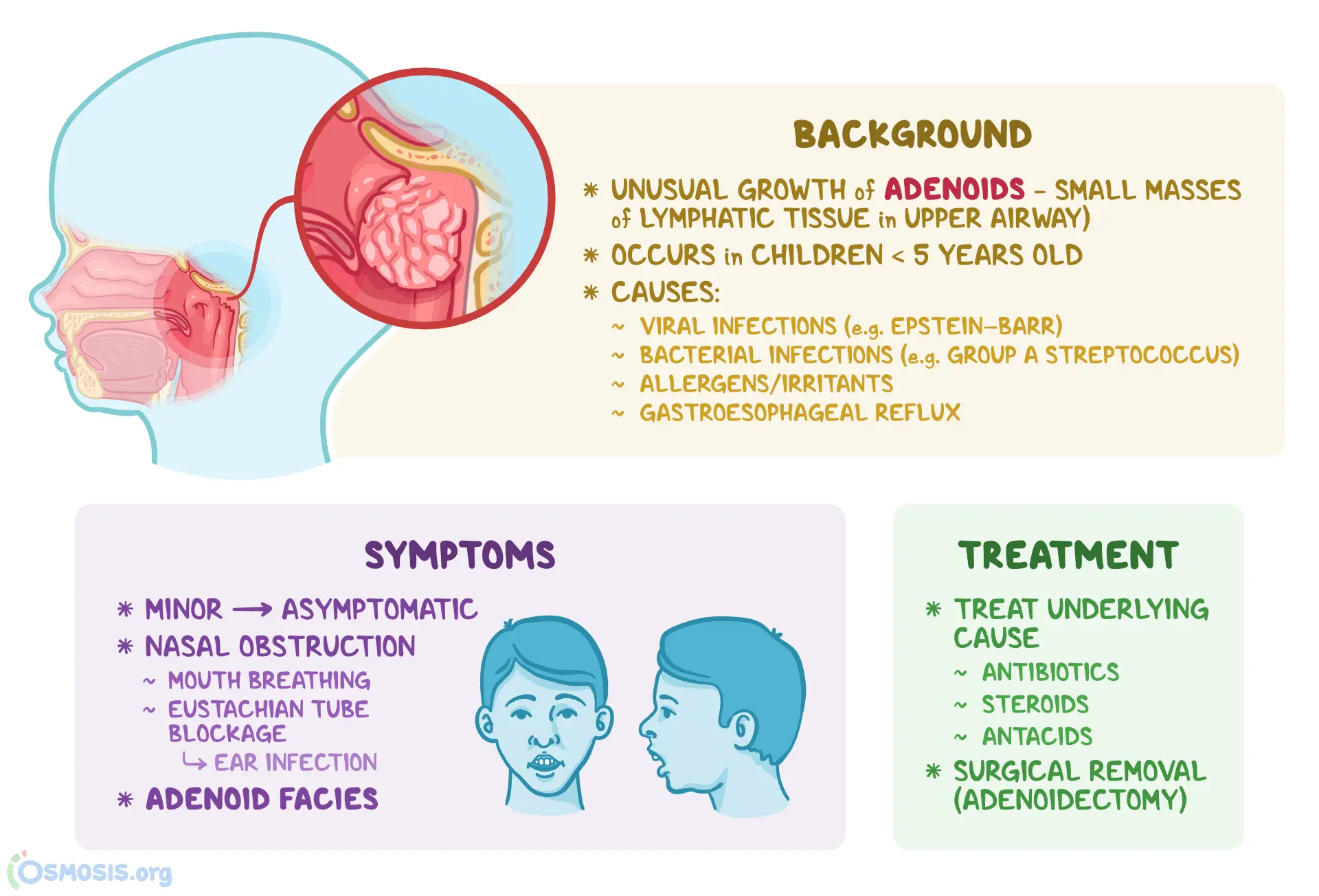 Adenotomy &#8211; symptoms of hypertrophy of the third tonsil, indications for surgery