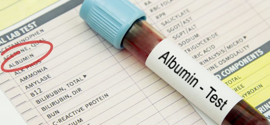 Albumin &#8211; when should the test be performed? Albumin standards