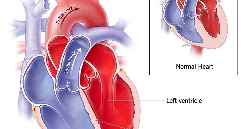 Alcohol affects the left ventricle differently than the right ventricle