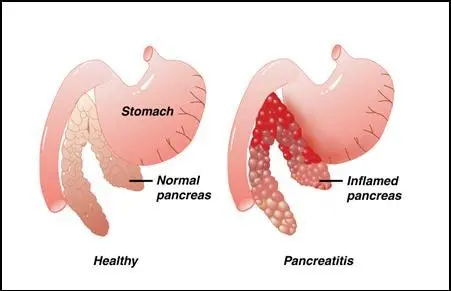 Alcohol and the condition of the liver, pancreas and skin