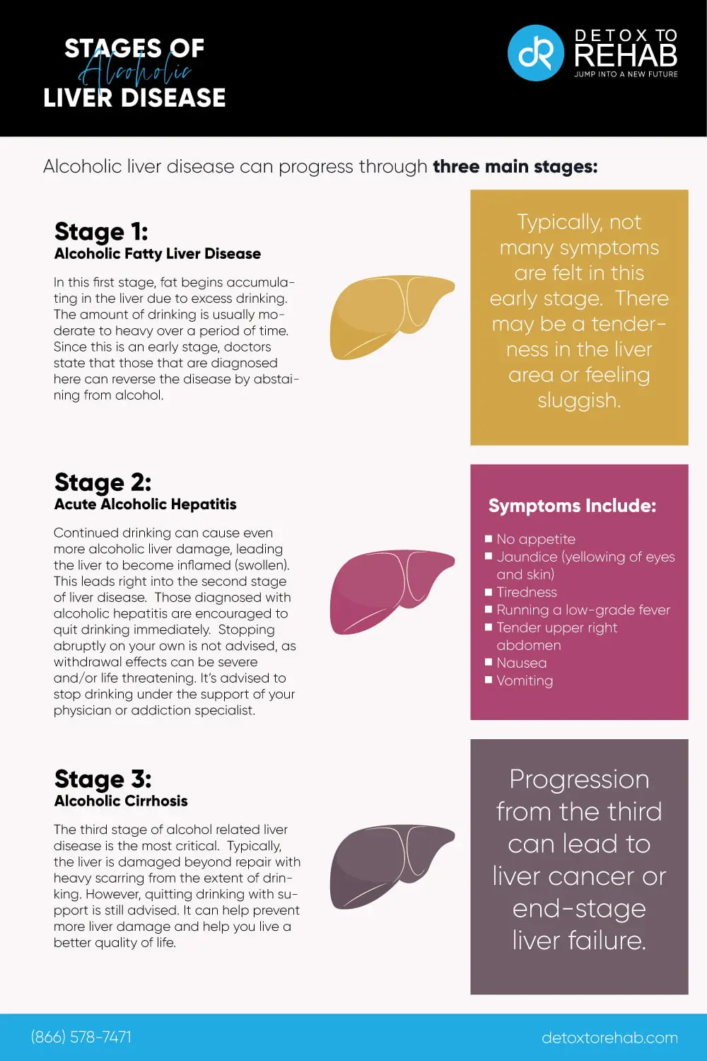 Alcoholic liver disease &#8211; what harms the liver and how to support it?