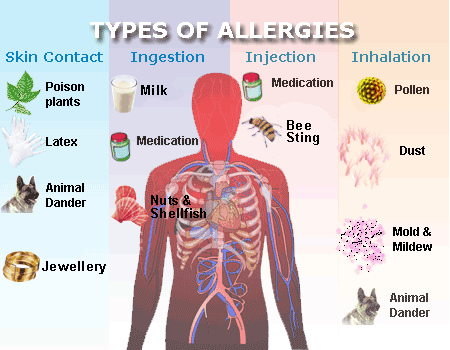 Allergy &#8211; types, symptoms, diagnosis. Treatment of allergies