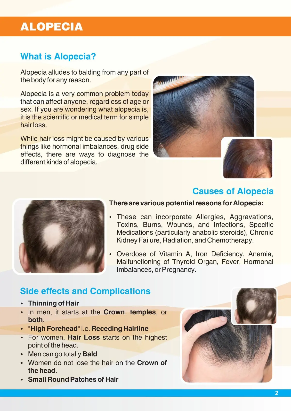 Alopecia &#8211; when and how to treat hair loss?