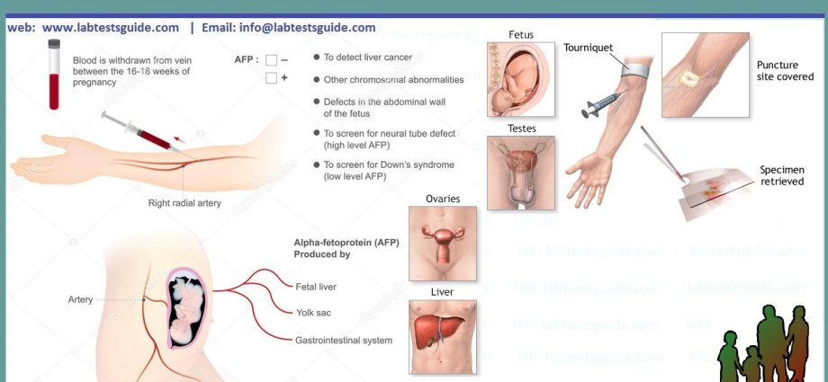 Alpha-fetoprotein (AF) &#8211; what is it, when to test, the importance of AF in pregnancy, analysis of test results